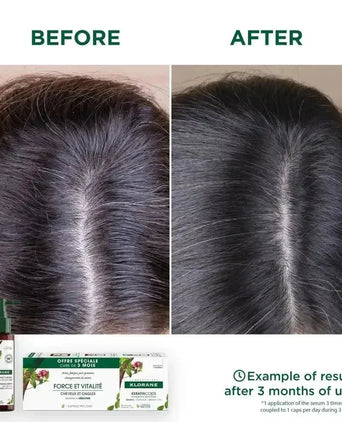 Klorane anti-haaruitval behandeling - Hairgivers