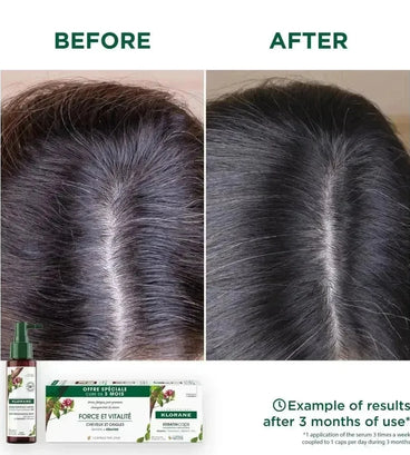 Klorane anti-haaruitval behandeling - Hairgivers