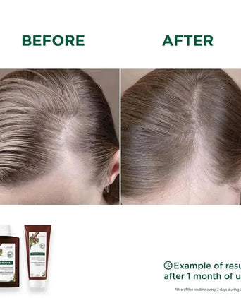 Klorane anti-haaruitval shampoo + conditioner - Hairgivers