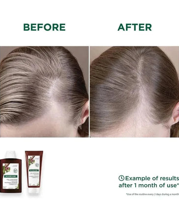 Klorane anti-haaruitval shampoo + conditioner Klorane anti-haaruitval shampoo + conditioner - Hairgivers