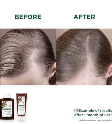 Klorane anti-haaruitval shampoo + conditioner - Hairgivers