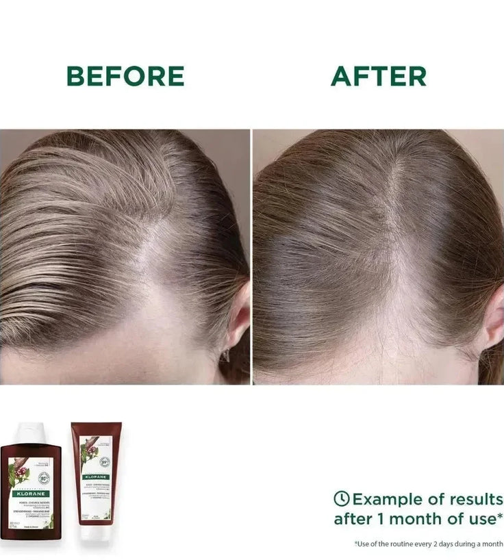 Klorane anti-haaruitval shampoo + conditioner - Hairgivers