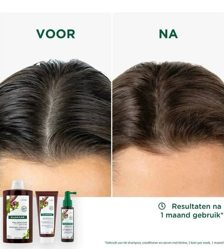 Klorane anti-haaruitval shampoo Kinine/Edelweiss (400 ml) - Hairgivers