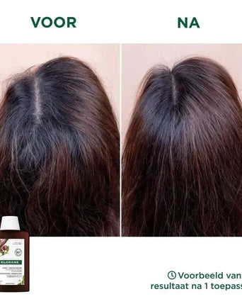 Klorane anti-haaruitval shampoo Kinine/Edelweiss (400 ml) - Hairgivers