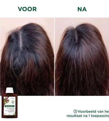 Klorane anti-haaruitval shampoo Kinine/Edelweiss (400 ml) - Hairgivers