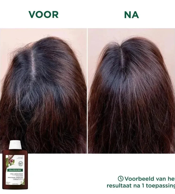Klorane anti-haaruitval shampoo Kinine/Edelweiss (400 ml) - Hairgivers