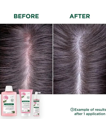 Klorane behandeling voor gevoelige hoofdhuid - Hairgivers