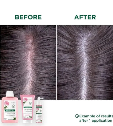 Klorane behandeling voor gevoelige hoofdhuid - Hairgivers
