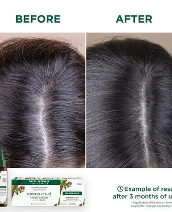 Klorane KeratinCaps (3 x 30 capsules) - Hairgivers