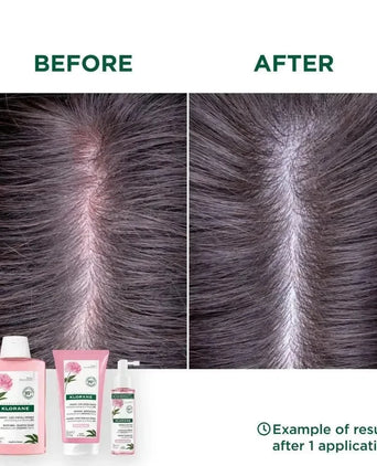 Klorane shampoo Pioenroos - gevoelige hoofdhuid (400 ml) - Hairgivers