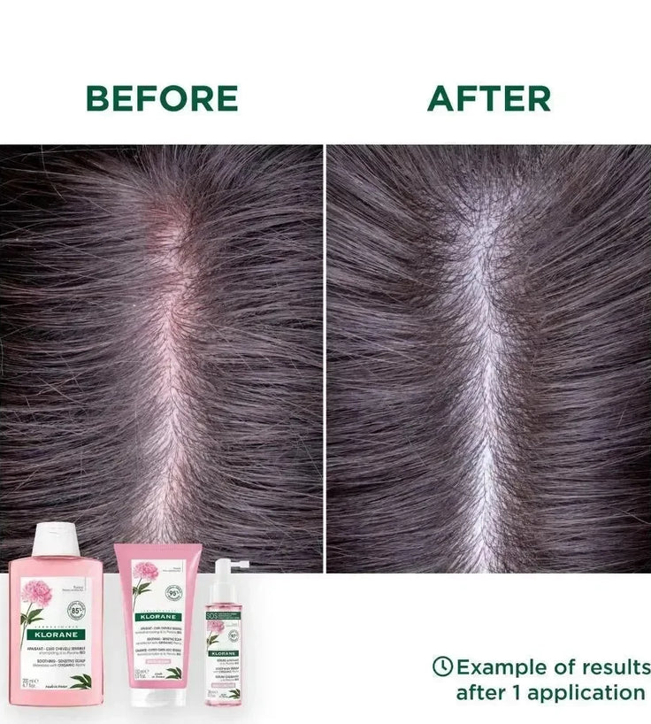 Klorane SOS serum gevoelige hoofdhuid Pioenroos (100 ml) - Hairgivers