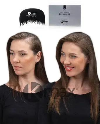 Kmax haarlijn optimalisator - Hairgivers