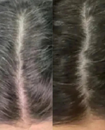 Neofollics anti-grey hair tablets - Hairgivers