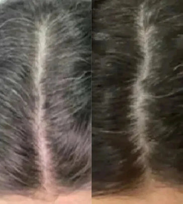 Neofollics Anti Grey Hair Tablets Neofollics anti-grey hair tablets - Hairgivers
