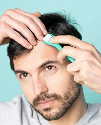 Neofollics scalp roller (0,3 mm) - Hairgivers