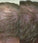 Neofollics haargroei shampoo + conditioner starter kit