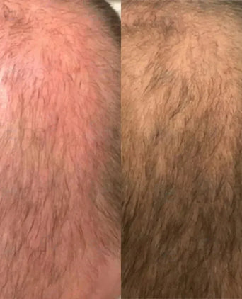 Panthrix haargroei serum (Redensyl) - Hairgivers