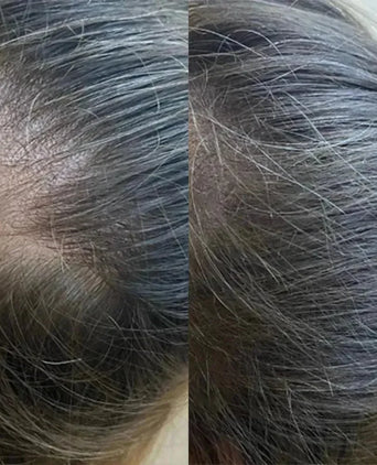 Panthrix haargroei serum (Redensyl) - Hairgivers