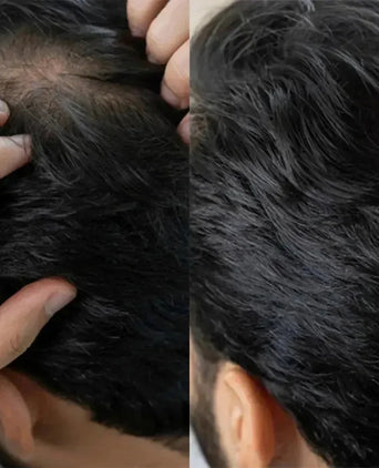 Panthrix haargroei serum (Redensyl) - Hairgivers