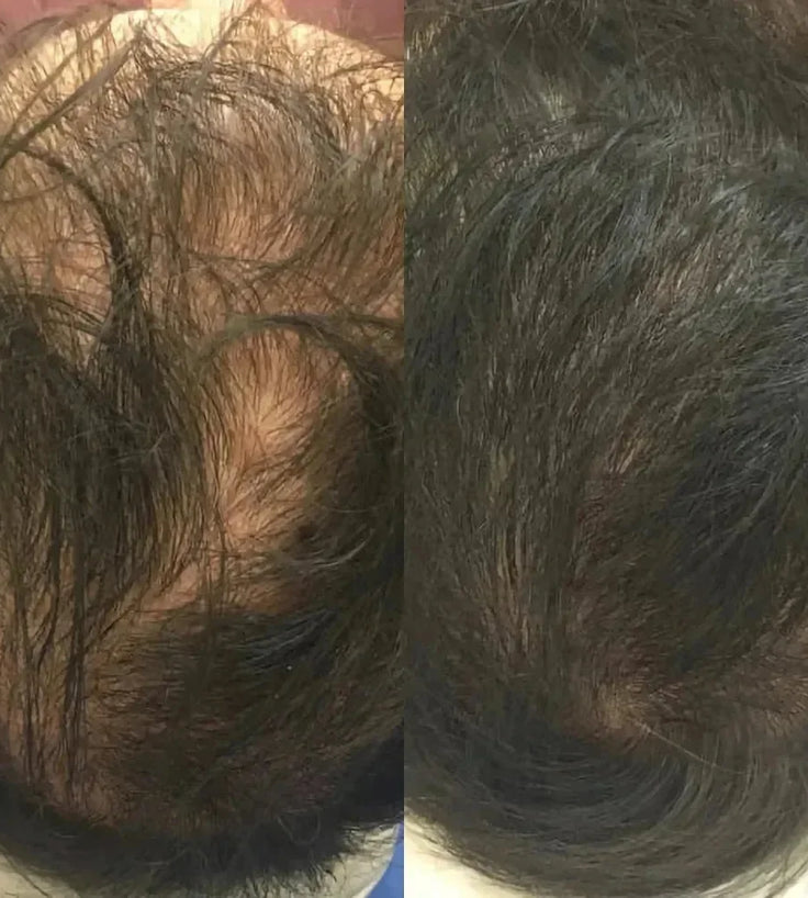 Revita haargroei shampoo + conditioner (205 ml) - Hairgivers