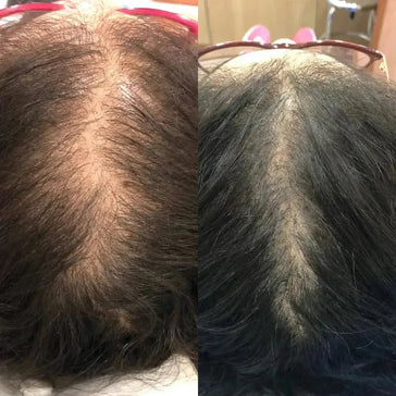Revita haargroei shampoo + conditioner (925 ml)