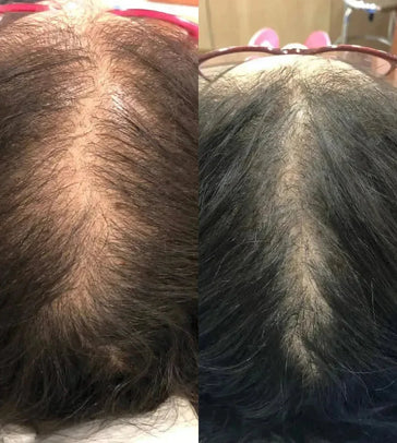 Revita haargroei shampoo + conditioner (925 ml)