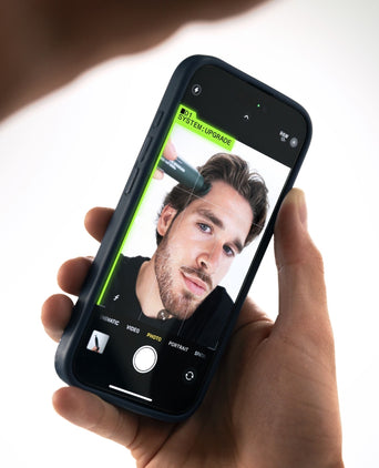 Scandinavian Biolabs Bio-Pilixin Hairline Booster navulling (3-pack)