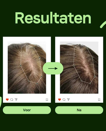 Scandinavian Biolabs Bio-Pilixin serum (man) - Hairgivers