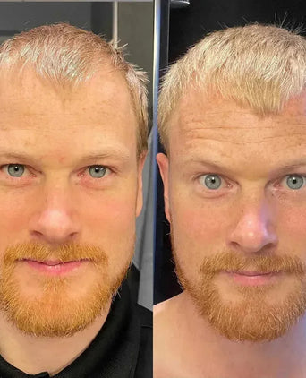 Scandinavian Biolabs Bio-Pilixin serum (man) - Hairgivers
