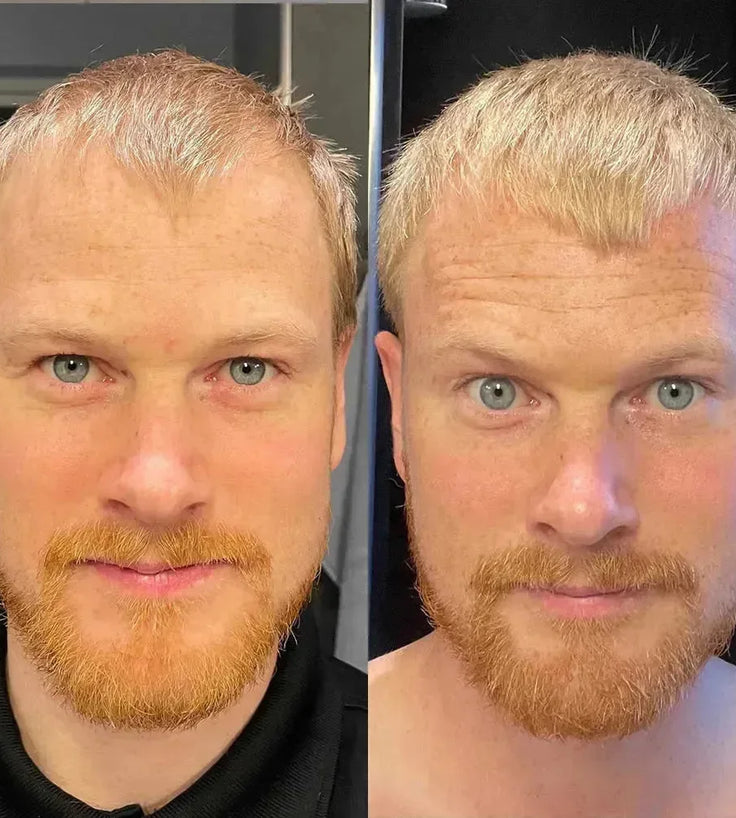 Scandinavian Biolabs Bio-Pilixin serum (man) - Hairgivers
