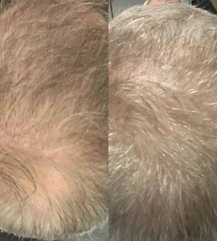 Scandinavian Biolabs Bio-Pilixin serum (man) - Hairgivers