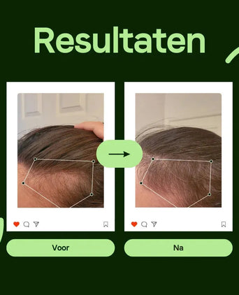 Scandinavian Biolabs Bio-Pilixin serum (man) - Hairgivers