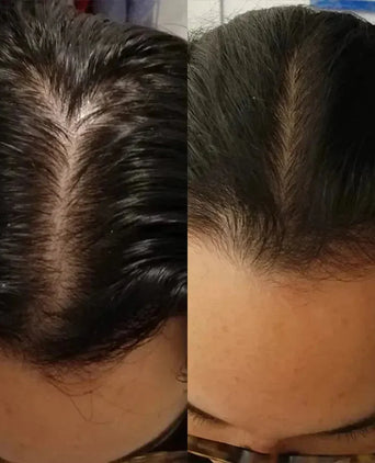 Scandinavian Biolabs Bio-Pilixin serum (vrouw) - Hairgivers
