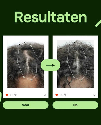 Scandinavian Biolabs Bio-Pilixin serum (vrouw) - Hairgivers