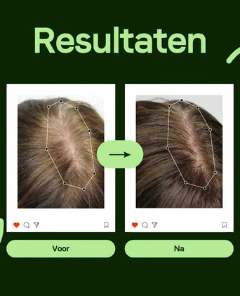 Scandinavian Biolabs Bio-Pilixin serum (vrouw) - Hairgivers