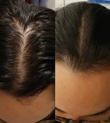 Scandinavian Biolabs Bio-Pilixin shampoo + conditioner vrouw (250 ml) - Hairgivers