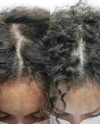 Scandinavian Biolabs haargroei behandeling (vrouw) - Hairgivers