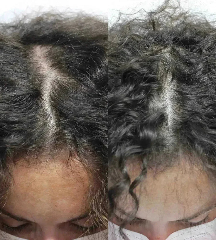 Scandinavian Biolabs haargroei behandeling (vrouw) - Hairgivers