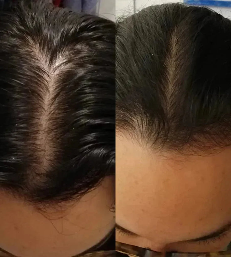 Scandinavian Biolabs haargroei behandeling (vrouw) - Hairgivers