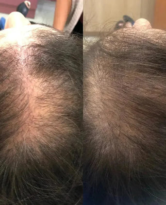 Spectral.CSF (Adenosine) lotion - Hairgivers