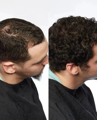 Theradome LH80 PRO laserhelm - Hairgivers