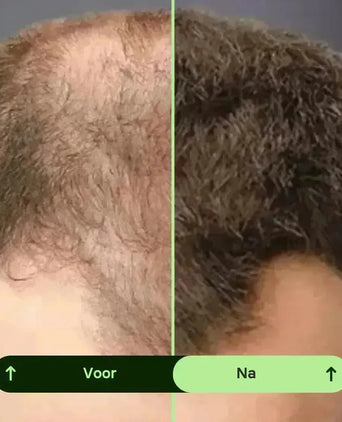 Toppik hair thickener kleurenspray - zwart - Hairgivers