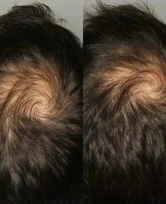 Viviscal hair growth supplement voor mannen (3 mnd) - Hairgivers