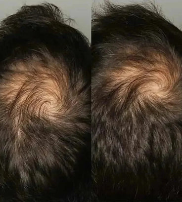 Viviscal hair growth supplement voor mannen (3 mnd) - Hairgivers