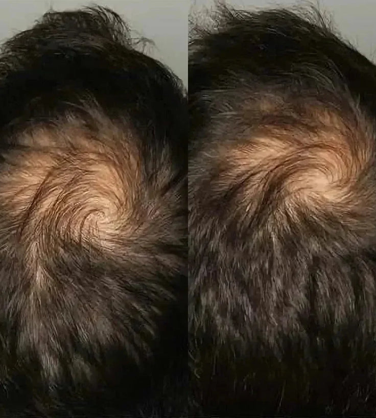 Viviscal hair growth supplement voor mannen (3 mnd) - Hairgivers