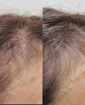 Viviscal hair growth supplement voor vrouwen (1 mnd) - Hairgivers