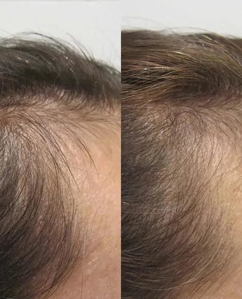 Viviscal hair growth supplement voor vrouwen (1 mnd) - Hairgivers