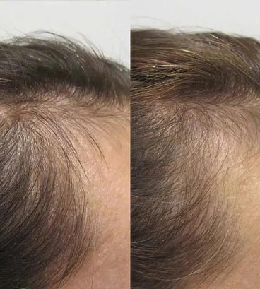 Viviscal hair growth supplement voor vrouwen (3 mnd) - Hairgivers